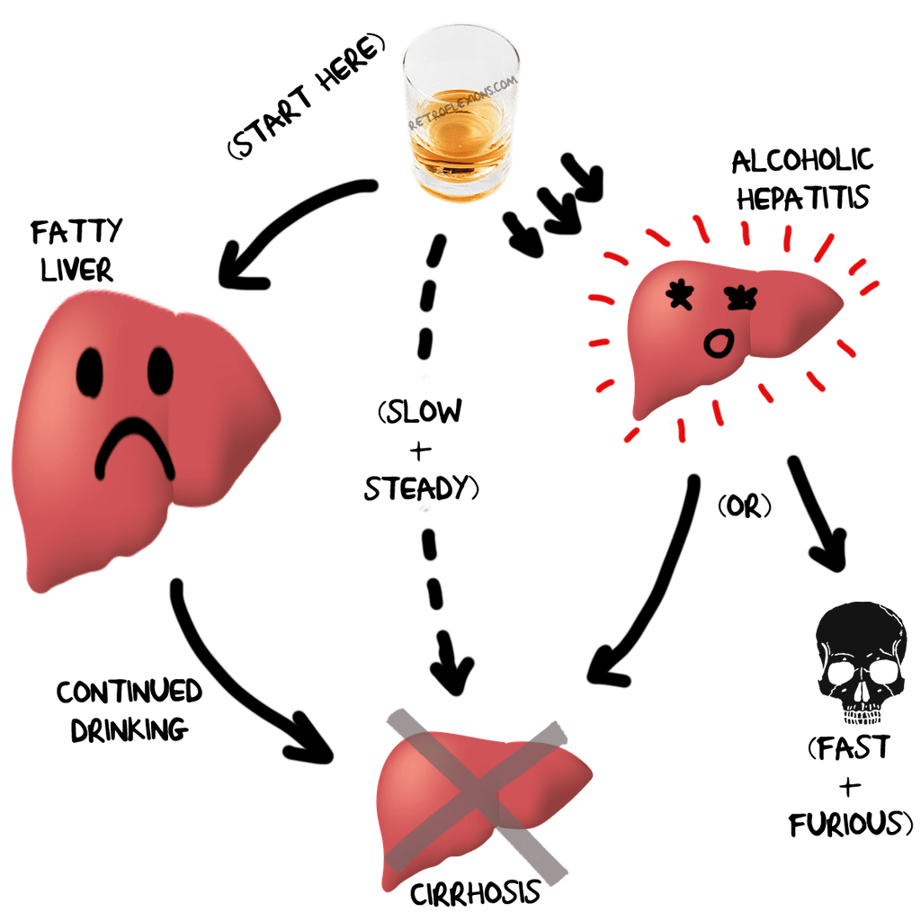 What Are Diseases That Can Affect The Liver